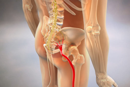 Sciatica, Herniated Disc, Lumbago: What Differences and How To Relieve Your Pain?